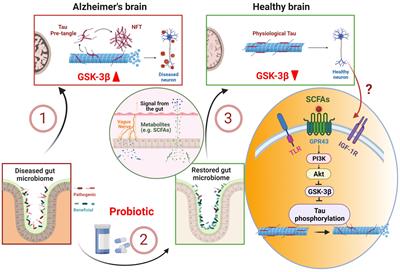 Probiotic supplement as a promising strategy in early tau pathology prevention: Focusing on GSK-3β?